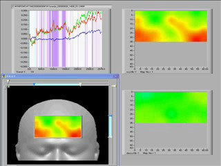 fNIRSによるHAI中の脳機能画像の計測